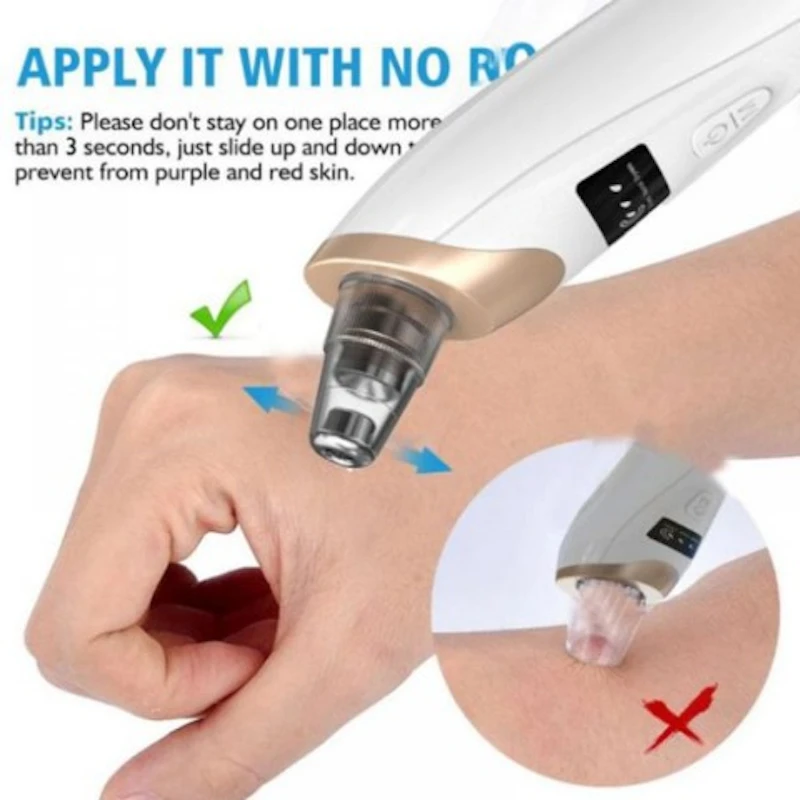 Beauty Instrument Blackhead Pore Cleaning