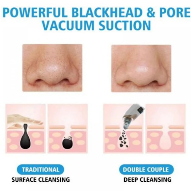 Beauty Instrument Blackhead Pore Cleaning