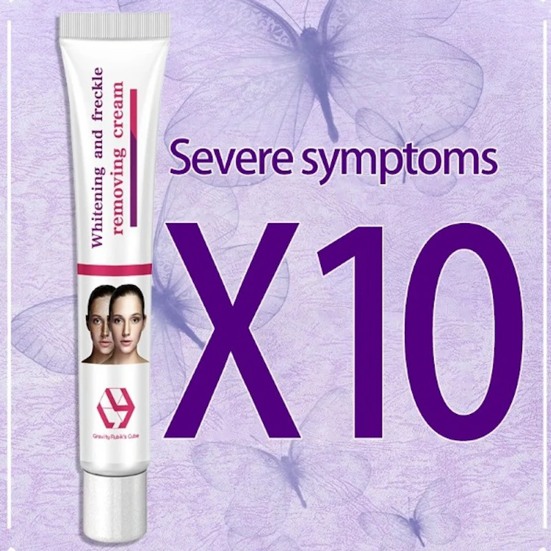 ZOO·SON® ANTI FRECKLE WHITENING PURPLE  CREAM