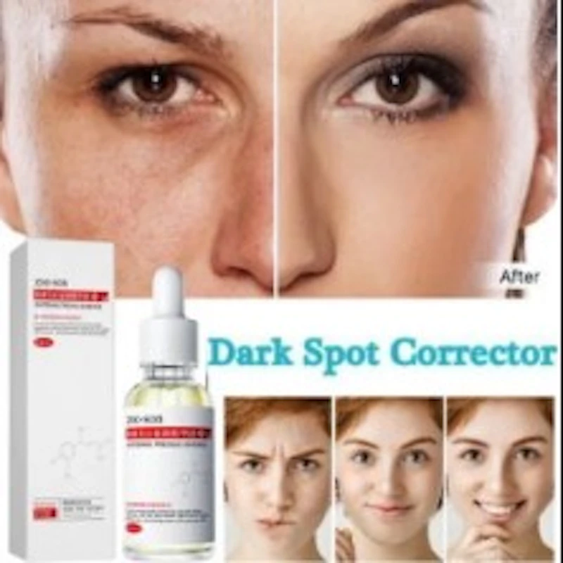 ZOO·SON® WHITENING FRECKLE ESSENCE ★★★★★ (918)