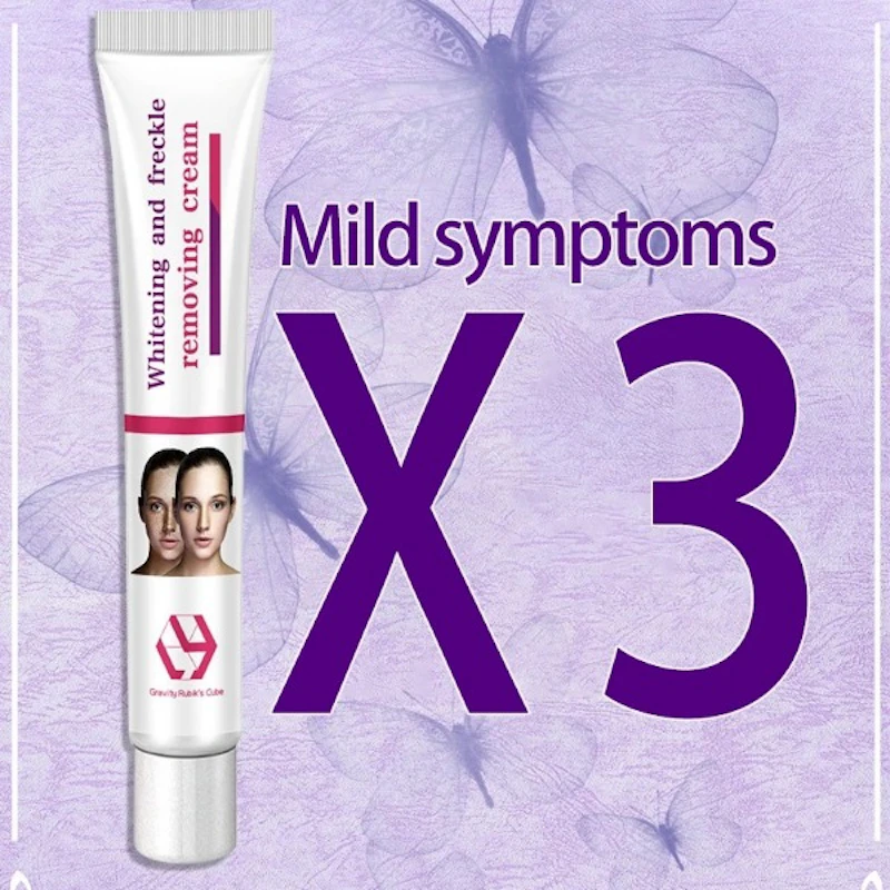 ZOO·SON® ANTI FRECKLE WHITENING PURPLE  CREAM