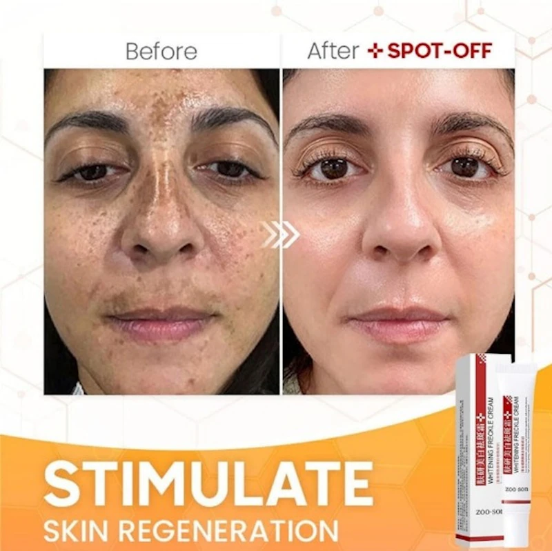  ANTI- FRECKLE WHITENING CREAM ★★★★★ (48791)